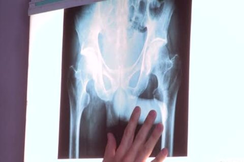 internal Specialists - JJ Knight, Landon Mycles